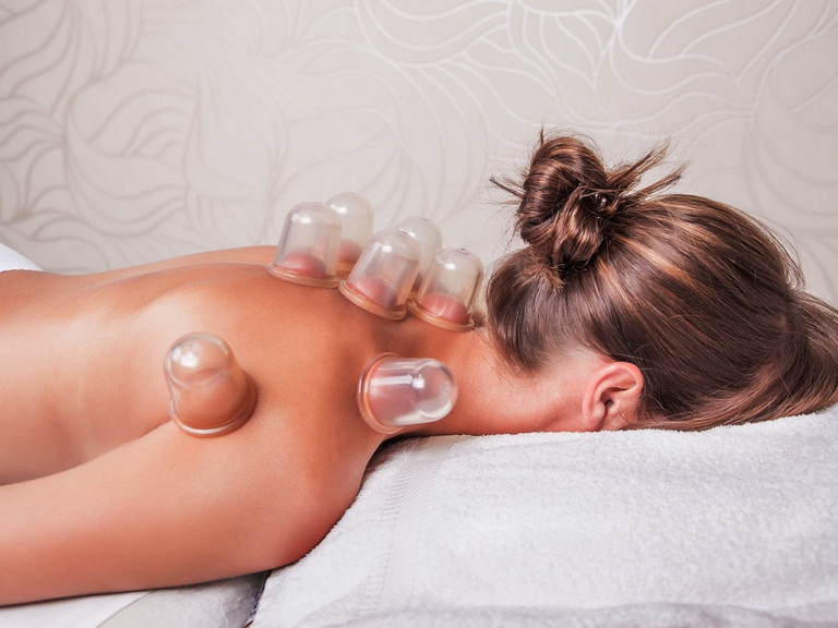 Cupping therapy - vacuum therapy